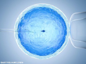 液氮储存